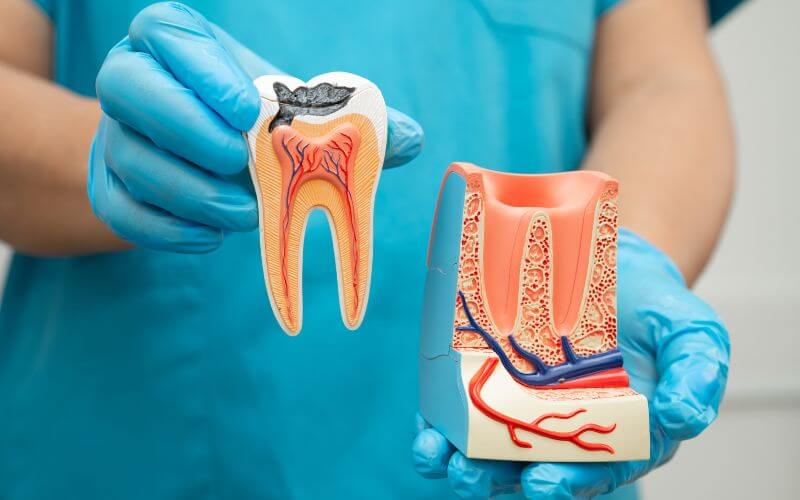 Root Canal Blog banner image
